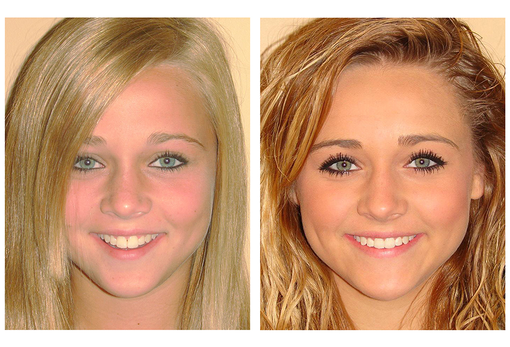 Morrison Dental Care