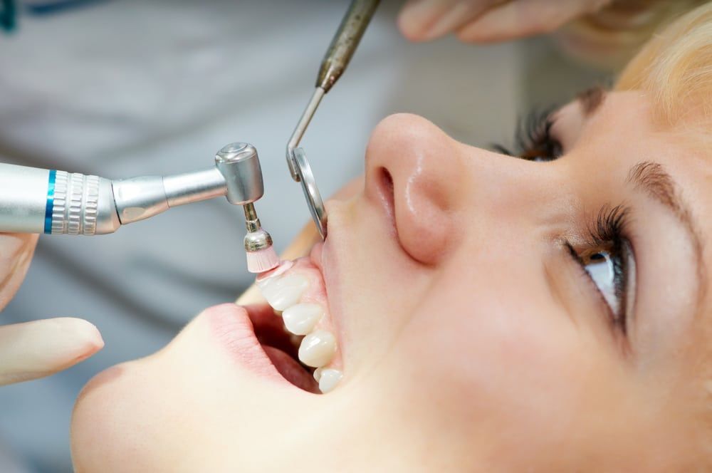 Dental Cleaning & Consultation