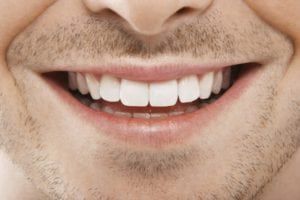 Man smiling with perfect teeth