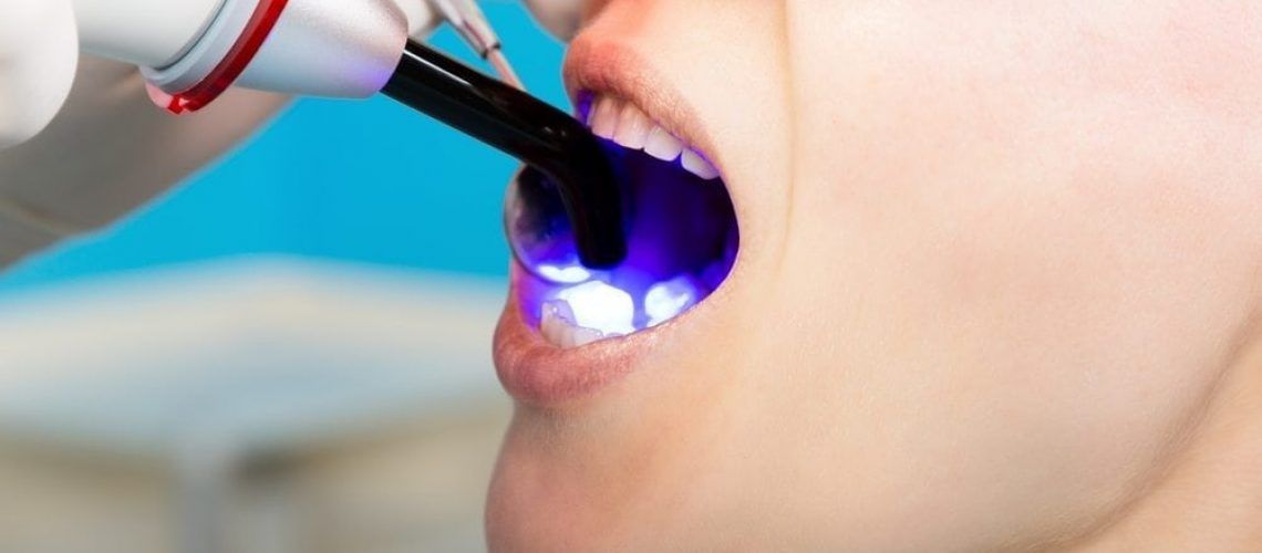 patient receiving dental bonding procedure from doctor